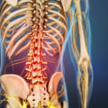 What are 3 causes of lower back pain?