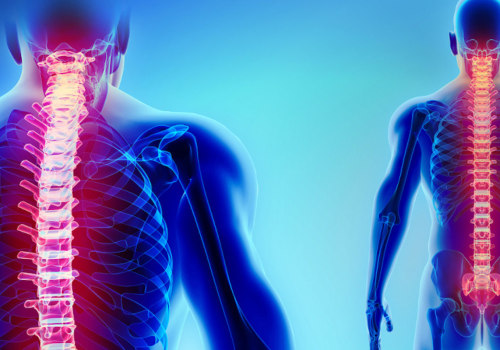 What back injury causes paralysis?